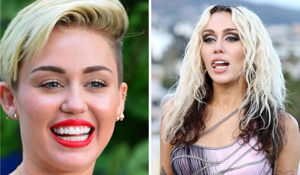 miley cyrus teeth
