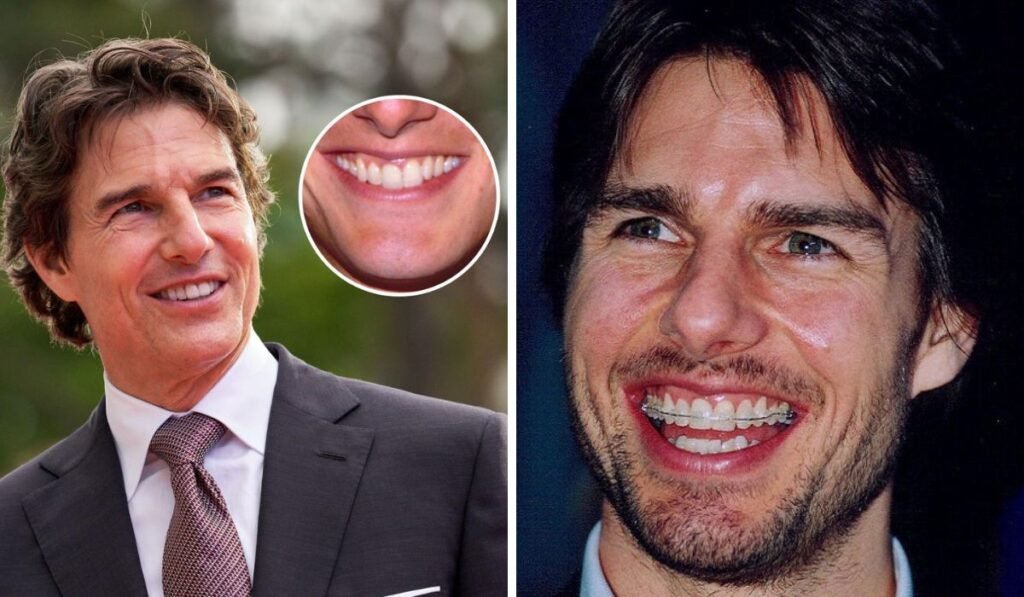 tom cruise smile